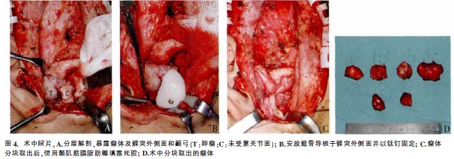 天博tb·体育综合官方网站上海成功举办“新华泌尿”高峰论坛 腹腔镜机器人手术演示及学习班圆满落幕(图1)