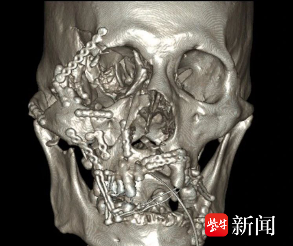 天博tb·体育综合官方网站迈普医学：4月25日接受机构调研华创证券、光大证券等多家机构参与(图1)